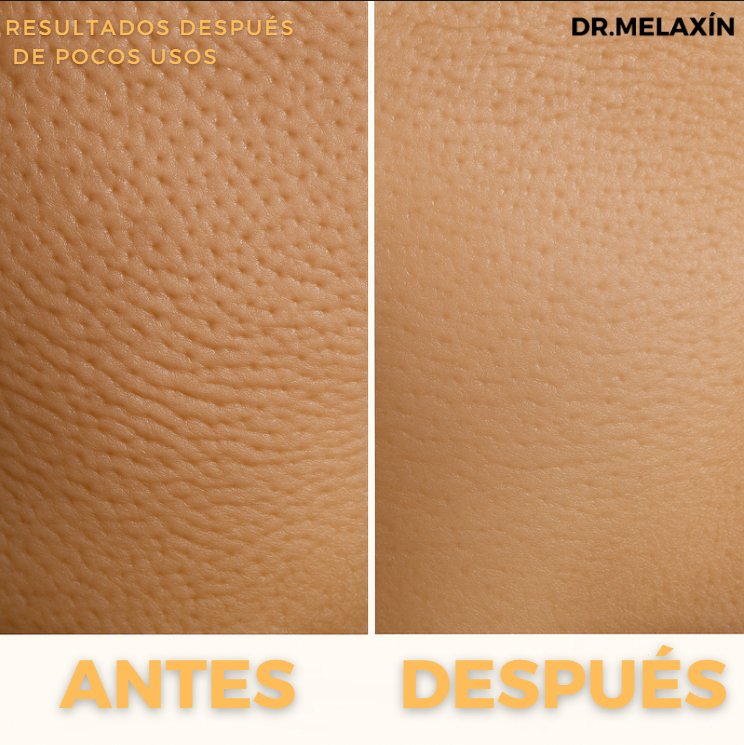 Exfoliante Anti-Imperfecciones Dr.Melaxín