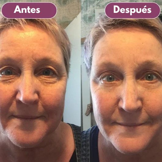 Bálsamo Reafirmante Dr.Melaxin